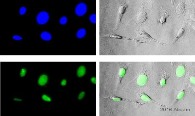Immunocytochemistry/ Immunofluorescence - Anti-Ki67 antibody [SP6] (AB16667)