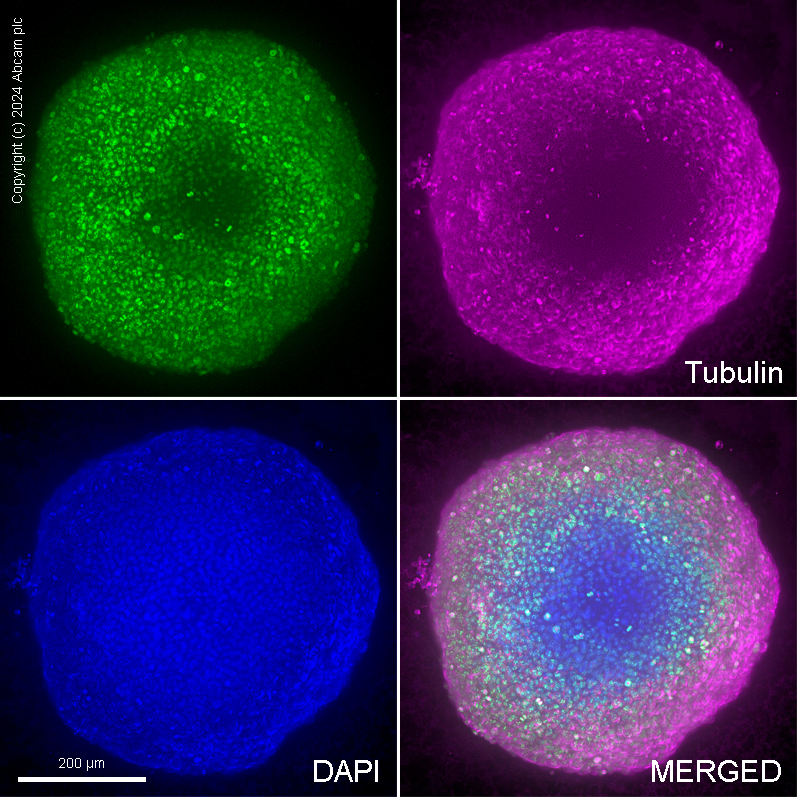 Immunocytochemistry/ Immunofluorescence - Anti-Ki67 antibody [SP6] (ab16667), expandable thumbnail