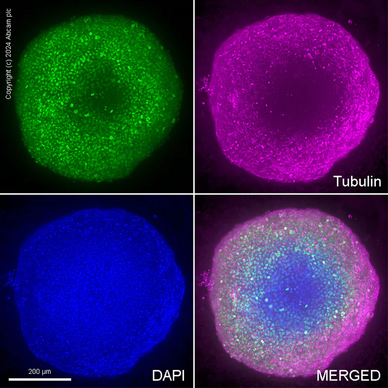 Immunocytochemistry/ Immunofluorescence - Anti-Ki67 antibody [SP6] (AB16667)