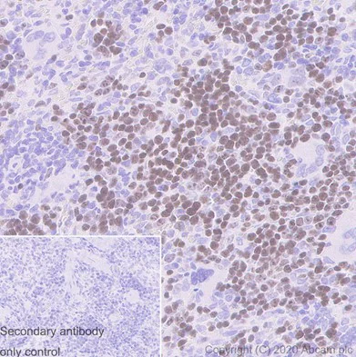 Immunohistochemistry (Formalin/PFA-fixed paraffin-embedded sections) - Anti-Ki67 antibody [SP6] (AB16667)