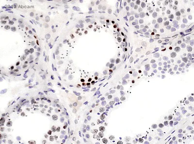 Immunohistochemistry (Formalin/PFA-fixed paraffin-embedded sections) - Anti-Ki67 antibody [SP6] (AB16667)