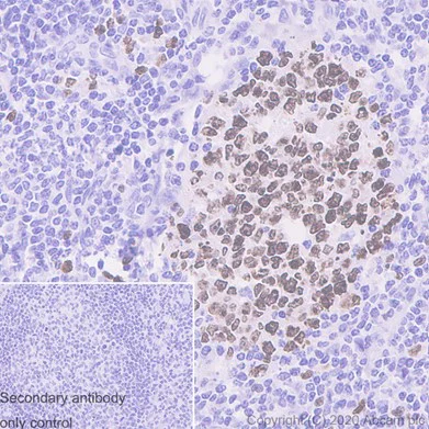 Immunohistochemistry (Formalin/PFA-fixed paraffin-embedded sections) - Anti-Ki67 antibody [SP6] (AB16667)