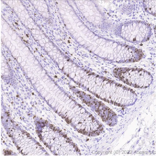 Immunohistochemistry (Formalin/PFA-fixed paraffin-embedded sections) - Anti-Ki67 antibody [SP6] (AB16667)