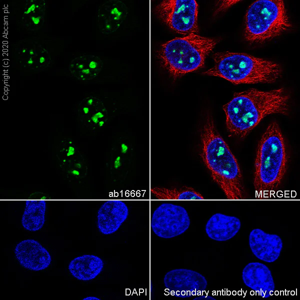 Immunocytochemistry/ Immunofluorescence - Anti-Ki67 antibody [SP6] - BSA and Azide free (AB197547)
