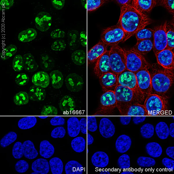 Immunocytochemistry/ Immunofluorescence - Anti-Ki67 antibody [SP6] - BSA and Azide free (AB197547)