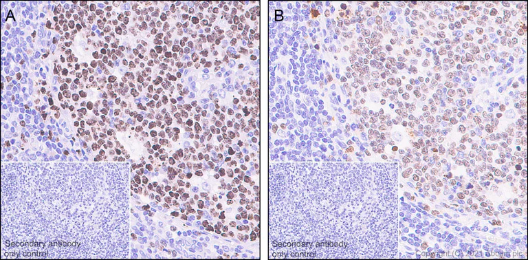 Immunohistochemistry (Formalin/PFA-fixed paraffin-embedded sections) - Anti-Ki67 antibody [SP6] - BSA and Azide free (AB197547)