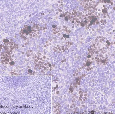 Immunohistochemistry (Formalin/PFA-fixed paraffin-embedded sections) - Anti-Ki67 antibody [SP6] - BSA and Azide free (AB197547)