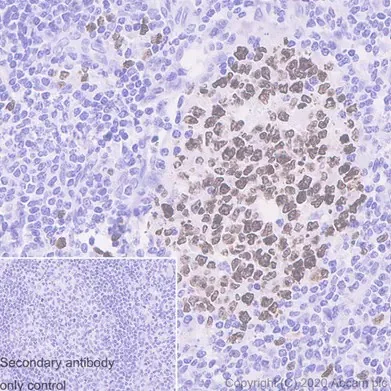 Immunohistochemistry (Formalin/PFA-fixed paraffin-embedded sections) - Anti-Ki67 antibody [SP6] - BSA and Azide free (AB197547)