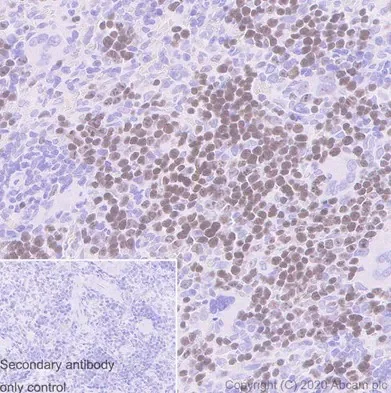 Anti-Ki67 antibody [SP6] - Carrier free (ab197547) | Abcam