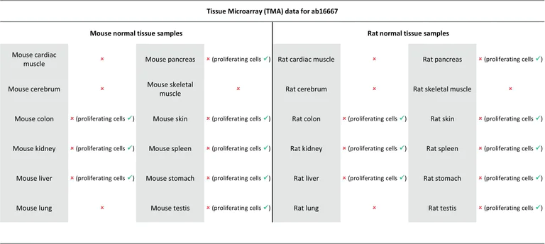 Immunohistochemistry (Formalin/PFA-fixed paraffin-embedded sections) - Anti-Ki67 antibody [SP6] - BSA and Azide free (AB197547)