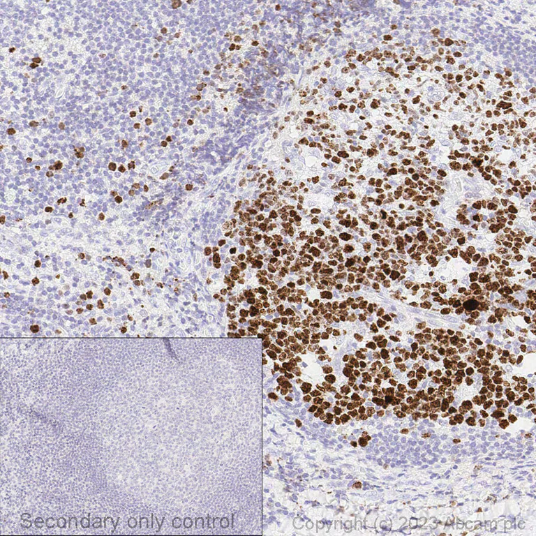 Immunohistochemistry (Formalin/PFA-fixed paraffin-embedded sections) - Anti-Ki67 antibody [SP6] - BSA and Azide free (AB197547)