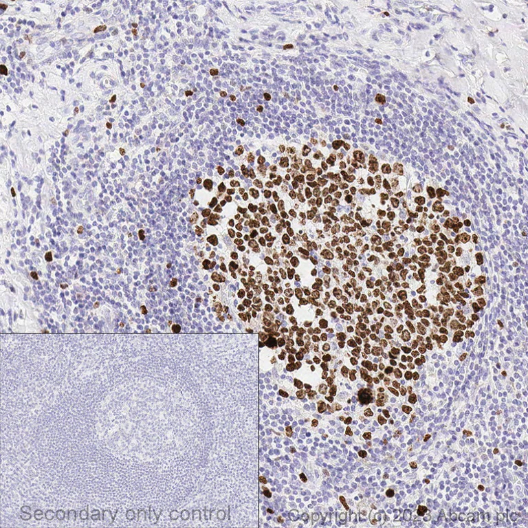 Immunohistochemistry (Formalin/PFA-fixed paraffin-embedded sections) - Anti-Ki67 antibody [SP6] - BSA and Azide free (AB197547)