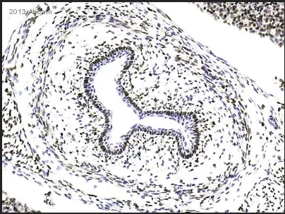 Immunohistochemistry (Formalin/PFA-fixed paraffin-embedded sections) - Anti-Ki67 antibody [SP6] - BSA and Azide free (AB197547)