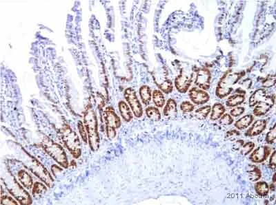 Immunohistochemistry (Formalin/PFA-fixed paraffin-embedded sections) - Anti-Ki67 antibody [SP6] - BSA free (AB231172)