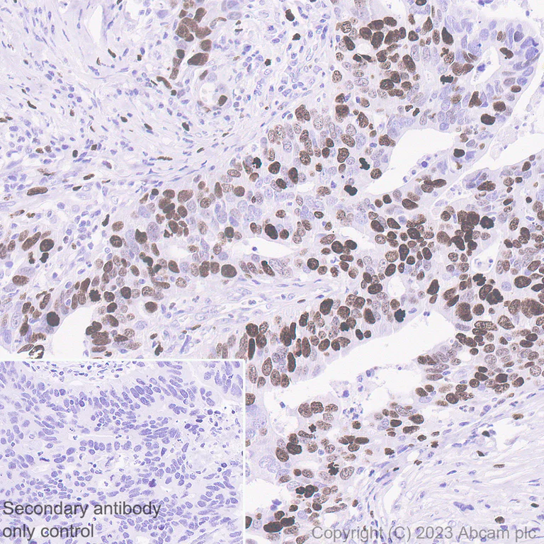 Immunohistochemistry (Formalin/PFA-fixed paraffin-embedded sections) - Anti-Ki67 antibody [SP6] - BSA free (AB231172)