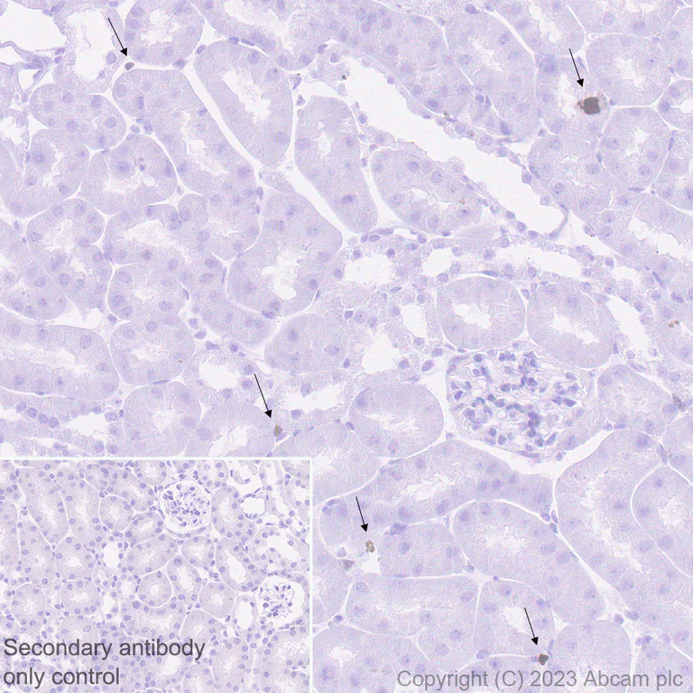 Immunohistochemistry (Formalin/PFA-fixed paraffin-embedded sections) - Anti-Ki67 antibody [SP6] - BSA free (AB231172)