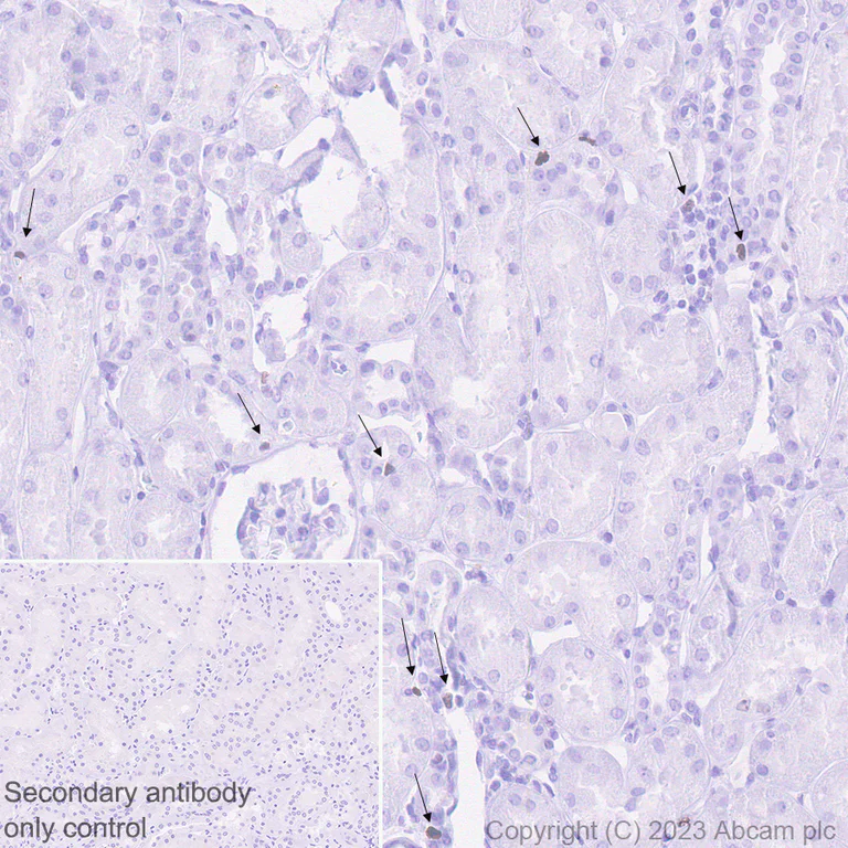 Immunohistochemistry (Formalin/PFA-fixed paraffin-embedded sections) - Anti-Ki67 antibody [SP6] - BSA free (AB231172)