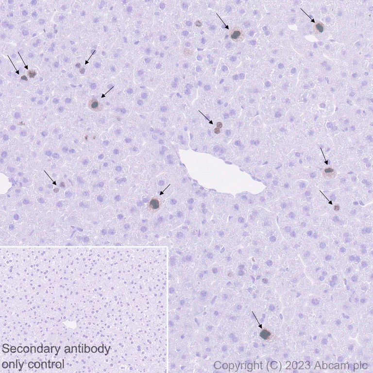 Immunohistochemistry (Formalin/PFA-fixed paraffin-embedded sections) - Anti-Ki67 antibody [SP6] - BSA free (AB231172)