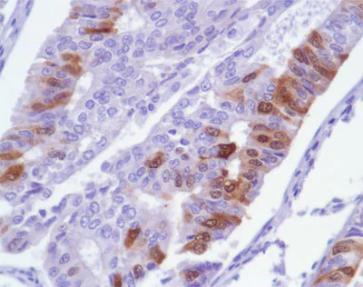 Immunohistochemistry (Formalin/PFA-fixed paraffin-embedded sections) - Anti-Ki67 antibody [SP6], prediluted (AB21700)