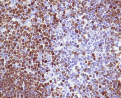 Immunohistochemistry (Formalin/PFA-fixed paraffin-embedded sections) - Anti-Ki67 antibody [SP6], prediluted (AB21700)