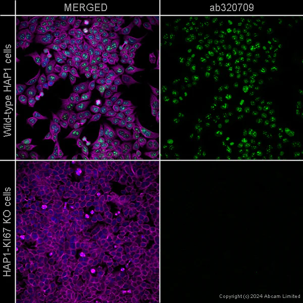 Anti-Ki67 [SP6] – Chicken IgY (Chimeric) (ab320709) | Abcam