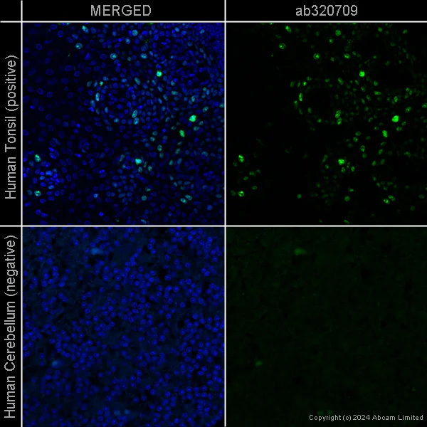 Immunohistochemistry (Formalin/PFA-fixed paraffin-embedded sections) - Anti-Ki67 [SP6] – Chicken IgY (Chimeric) – BSA and Azide Free (AB320710)