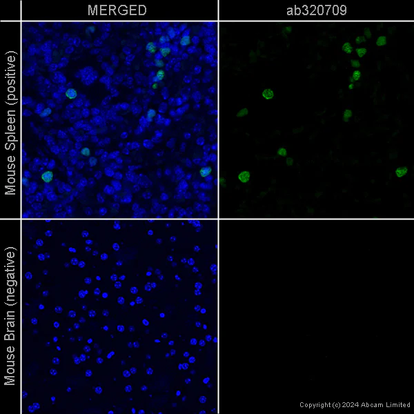 Immunohistochemistry (Formalin/PFA-fixed paraffin-embedded sections) - Anti-Ki67 [SP6] – Chicken IgY (Chimeric) – BSA and Azide Free (AB320710)