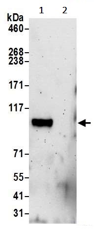 Immunoprecipitation - Anti-KIAA0090 antibody (AB242090)