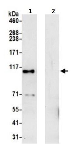 Immunoprecipitation - Anti-KIAA0090 antibody (AB242112)