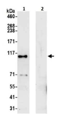 Immunoprecipitation - Anti-KIAA0090 antibody (AB242112)