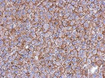 Immunohistochemistry (Formalin/PFA-fixed paraffin-embedded sections) - Anti-KIAA0090 antibody - N-terminal (AB153890), expandable thumbnail