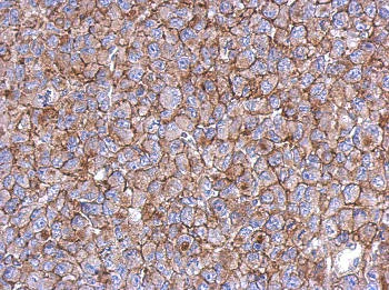 Immunohistochemistry (Formalin/PFA-fixed paraffin-embedded sections) - Anti-KIAA0090 antibody - N-terminal (AB153890)