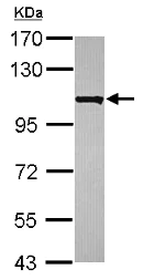 Western blot - Anti-KIAA0090 antibody - N-terminal (AB153890)