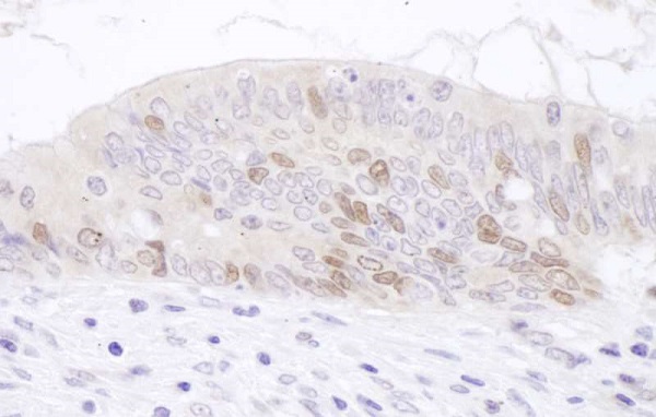 Immunohistochemistry (Formalin/PFA-fixed paraffin-embedded sections) - Anti-KIAA0101 antibody (AB226255)