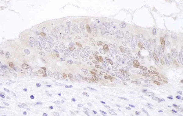 Immunohistochemistry (Formalin/PFA-fixed paraffin-embedded sections) - Anti-KIAA0101 antibody (AB226255)