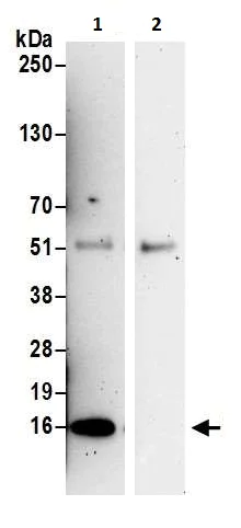 Immunoprecipitation - Anti-KIAA0101 antibody (AB226255)