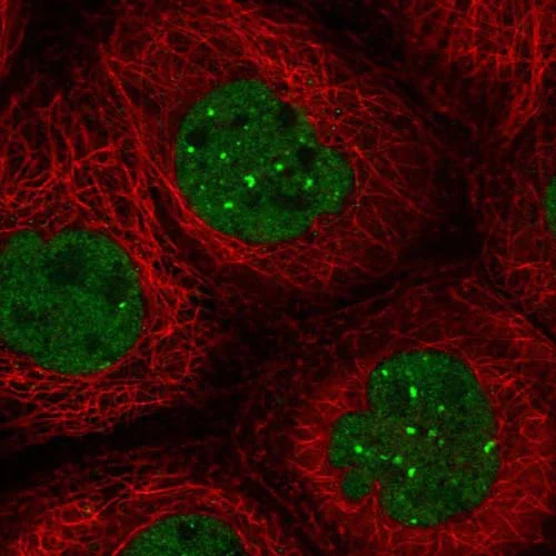 Immunocytochemistry/ Immunofluorescence - Anti-KIAA0195 antibody (AB121280)