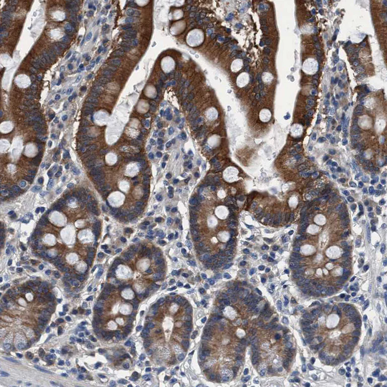 Immunohistochemistry (Formalin/PFA-fixed paraffin-embedded sections) - Anti-KIAA0195 antibody (AB121280)