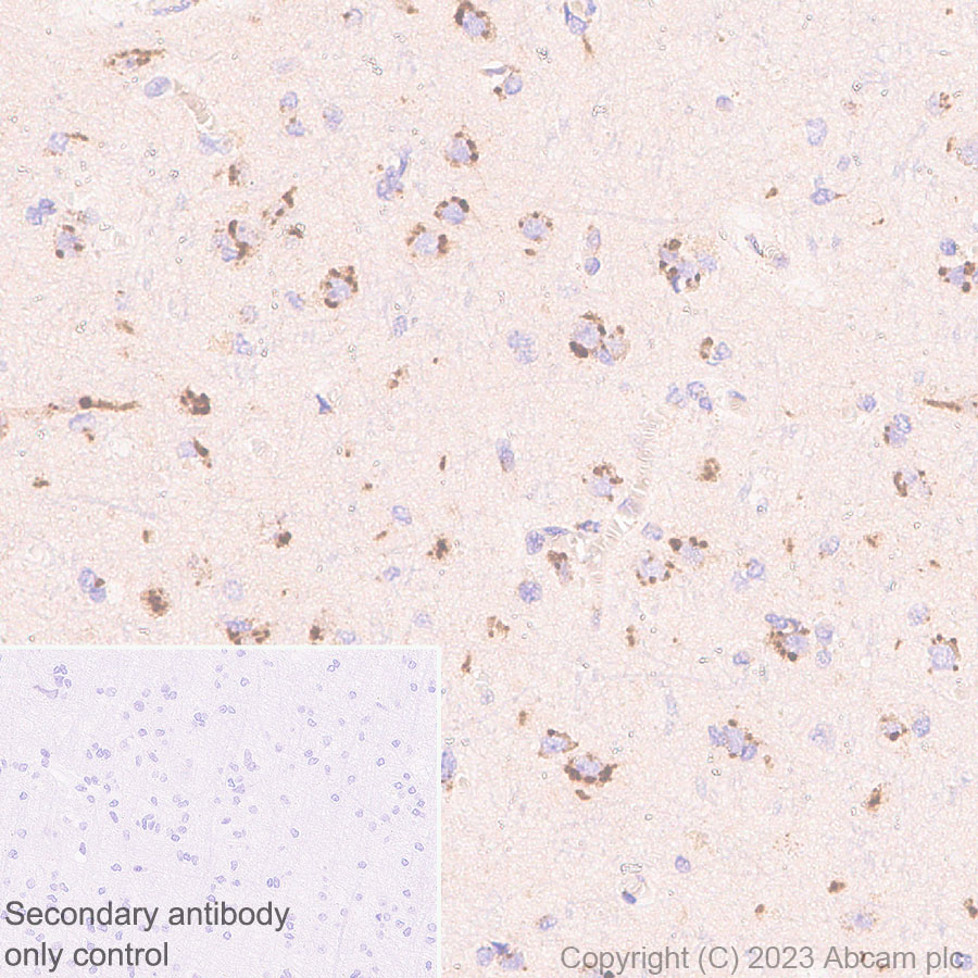 Immunohistochemistry (Formalin/PFA-fixed paraffin-embedded sections) - Anti-KIAA0319L antibody [EPR28329-62] (AB315027)