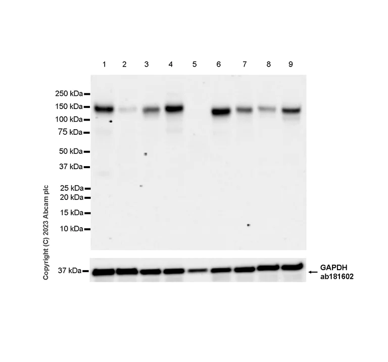 Western blot - Anti-KIAA0319L antibody [EPR28329-62] (AB315027)
