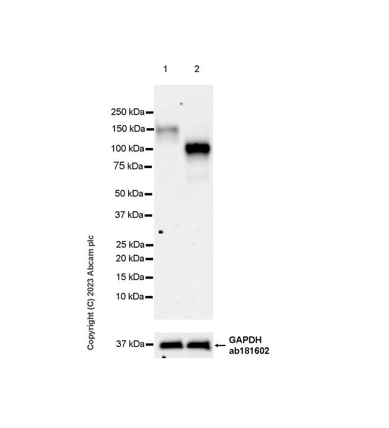 Western blot - Anti-KIAA0319L antibody [EPR28329-62] (AB315027)