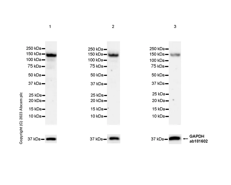 Western blot - Anti-KIAA0319L antibody [EPR28329-62] - BSA and Azide free (AB315028)