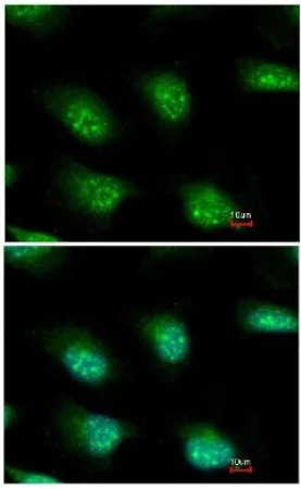 Immunocytochemistry/ Immunofluorescence - Anti-KIAA0323 antibody - C-terminal (AB154059)
