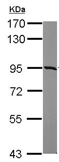 Western blot - Anti-KIAA0323 antibody - C-terminal (AB154059)