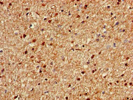 Immunohistochemistry (Formalin/PFA-fixed paraffin-embedded sections) - Anti-KIAA0467 antibody (AB234683)