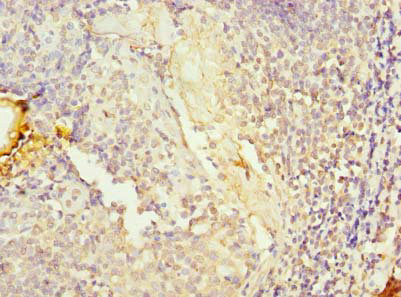 Immunohistochemistry (Formalin/PFA-fixed paraffin-embedded sections) - Anti-KIAA0907 antibody (AB235418), expandable thumbnail