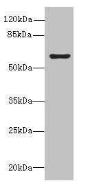 Western blot - Anti-KIAA0907 antibody (AB235418), expandable thumbnail
