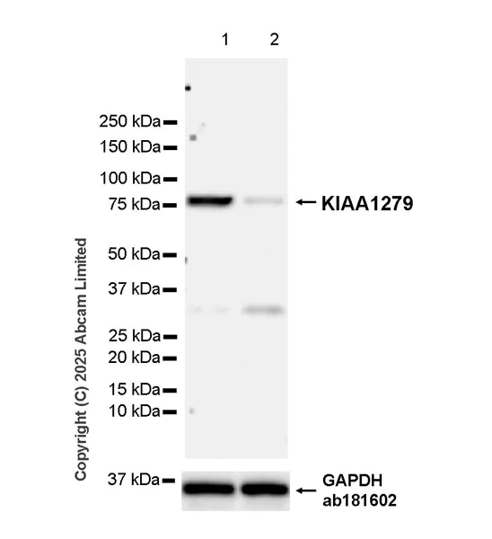 Western blot - Anti-KIAA1279 antibody [EPR30401-526] (AB324162)
