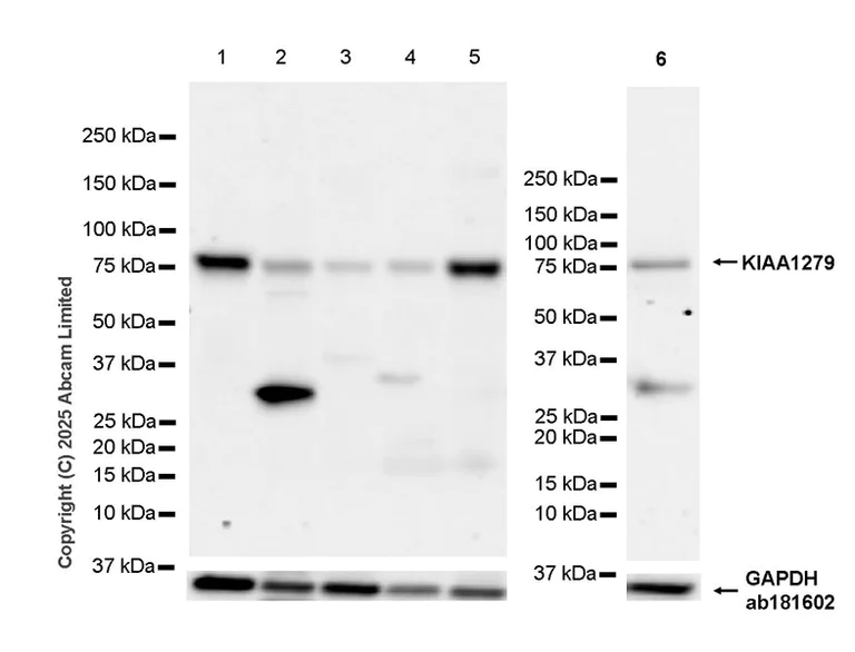 Western blot - Anti-KIAA1279 antibody [EPR30401-526] (AB324162)