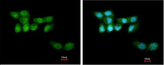 Immunocytochemistry/ Immunofluorescence - Anti-KIAA1530 antibody - N-terminal (AB137644)